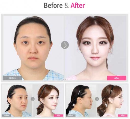 렛미인 이미지