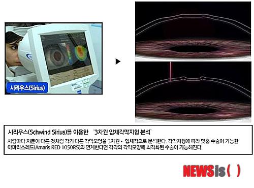 레드김 이미지
