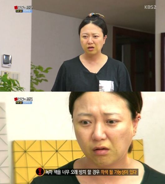김숙피부 이미지
