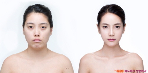 렛미인 이미지