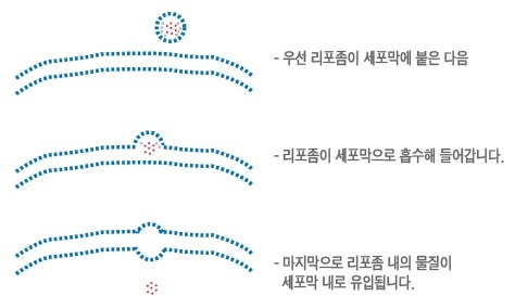 스피니 이미지