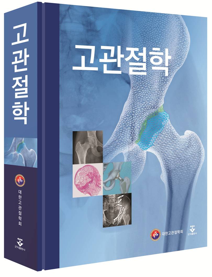 고관 이미지