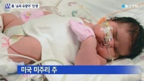 우량아 이미지