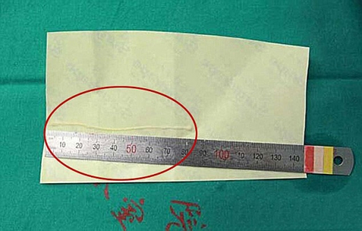 와우고기 이미지