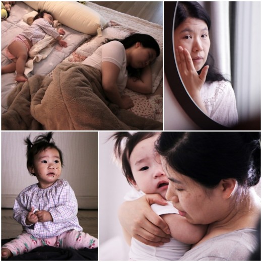 레드아이 이미지