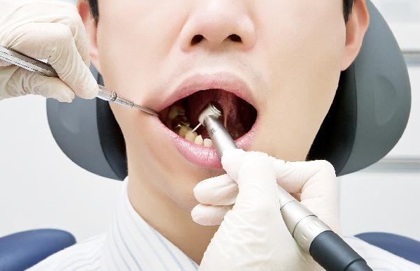 [헬스조선]치과 진료를 받는 남성/사진=헬스조선 DB