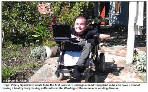 [단독] '머리이식수술' 논문 데이터 확보..올 상반기 발표 - 세계일보