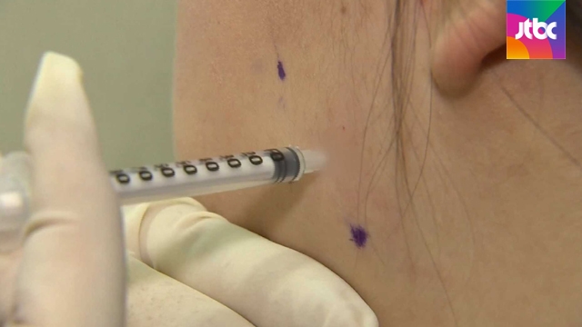 처음 몇 번 갸름해지더니..'보톡스' 자주 맞으면 내성 - JTBC