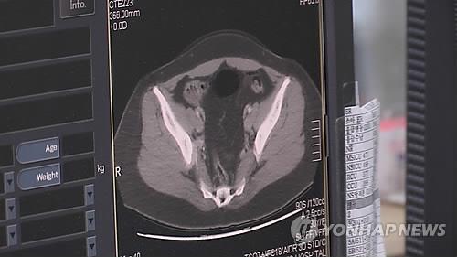 스웨덴 연구진, 집중력 높이는 특정 신경세포 발견 - 연합뉴스