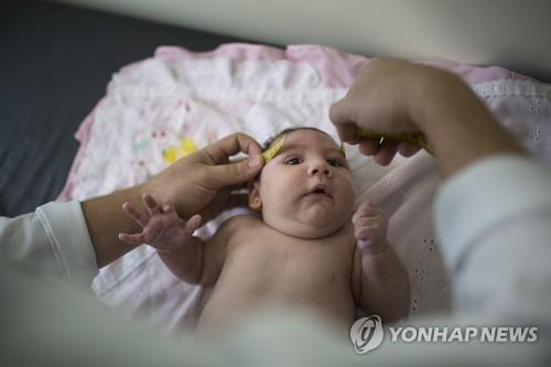 확산일로 소두증에 올림픽 앞둔 브라질 초비상 - 연합뉴스