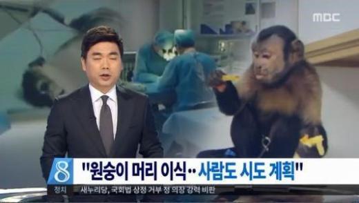 머리박사 이미지