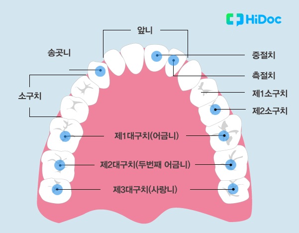 사랑니의 위치