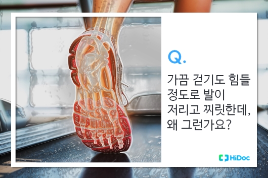 발로만 이미지