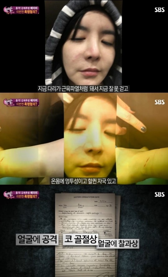 에이미 이미지