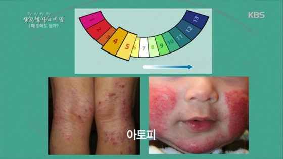 민*김* 이미지