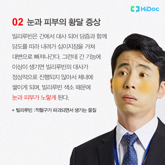 눈과 피부의 황달 증상