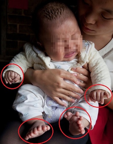 손가락발가락 이미지