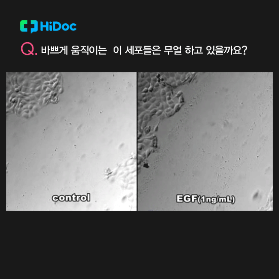 모르는데 어떻게 써요? 화장품 성분, 알고 쓰자!