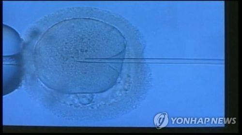 수정 이미지