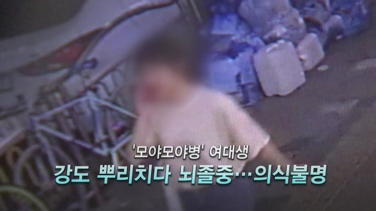 '모야모야병' 앓던 여대생, 강도 뿌리치다 의식불명 - YTN