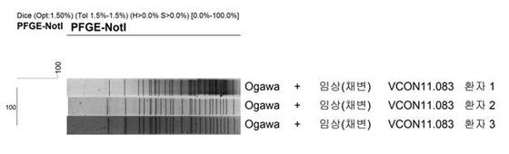 거제 콜레라 환자 3명 유전자형 '동일'..같은 오염원 추정 - 뉴스1