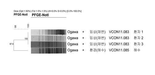 거제 오염된 바닷물, 콜레라 감염원 가능성 커졌다 - 국민일보
