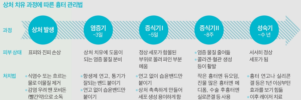 발라 이미지