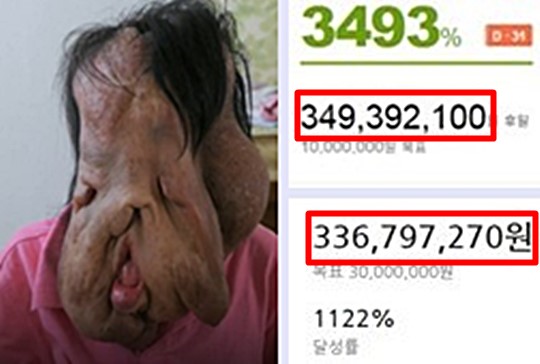 '모금사상 역대급' 하루 7억 모인 현희씨 사연 - 국민일보