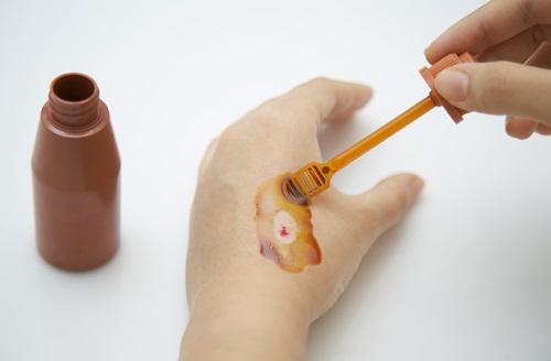 [헬스조선]상처가 났을 때 무턱대고 소독약이나 연고를 발랐다 회복이 더뎌질 수 있다/사진=헬스조선 DB