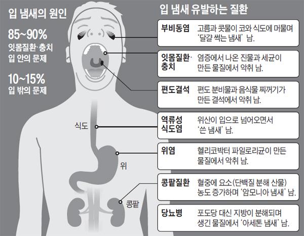 [헬스조선]입 냄새를 유발하는 원인/사진=헬스조선 DB