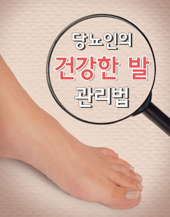 발관리 이미지