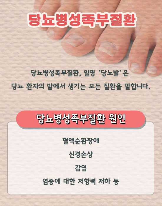 발관리 이미지