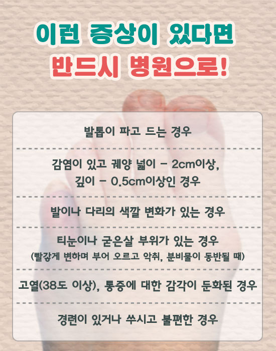 발관리 이미지
