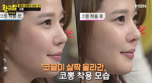 황금알 이미지