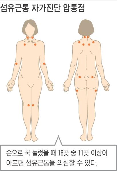 [헬스조선]특별한 이유 없이 온몸이 쑤시고 피곤하다면 '섬유근통'을 의심해봐야 한다/사진=조선일보 DB