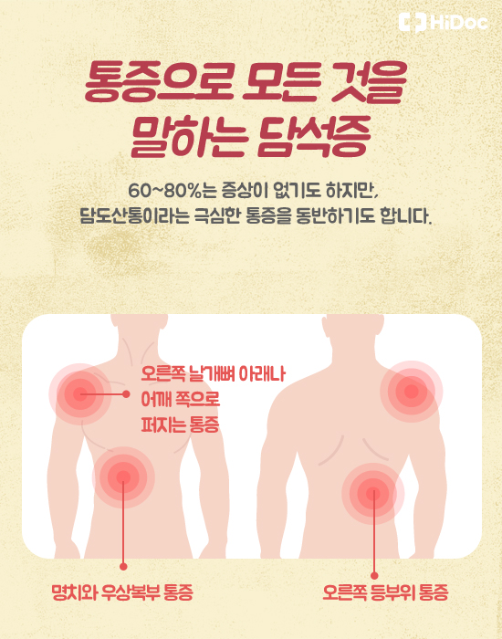 통증으로 모든 것을 말하는 담석증