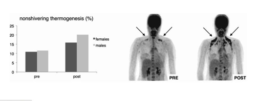 쾌적온도보다 낮은 기온에 일정 기간동안 노출시키기 전(왼쪽)에 비해 노출 뒤(오른쪽)  어깨 등 골격근의 갈색지방이 늘어나고 활성화된 모습. [리흐턴벨트 교수팀이 2016년 6월 국제학술지 '당뇨병(diabetes)에 게재한 별도 논문 '단기간의 추위 인체적응이 비만인의 갈색지방조직을 활성화'에서 캡처]