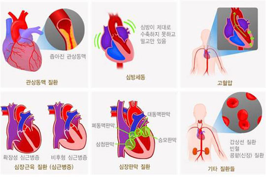부전기획 이미지