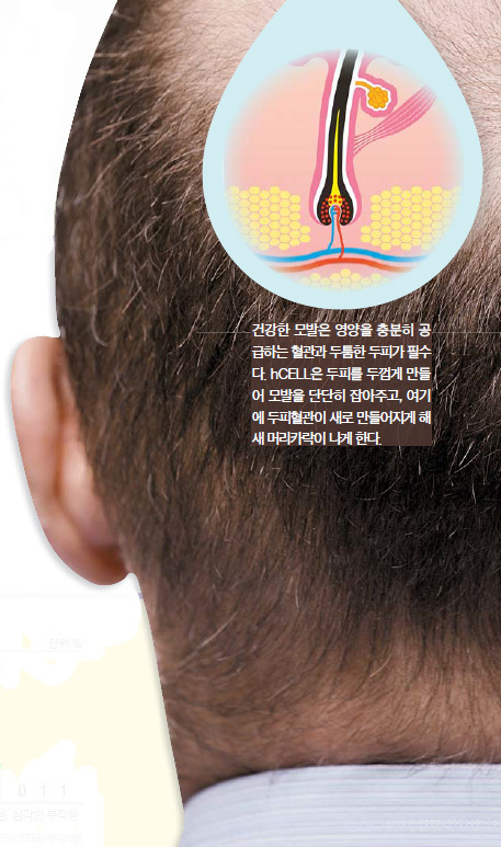 발라 이미지