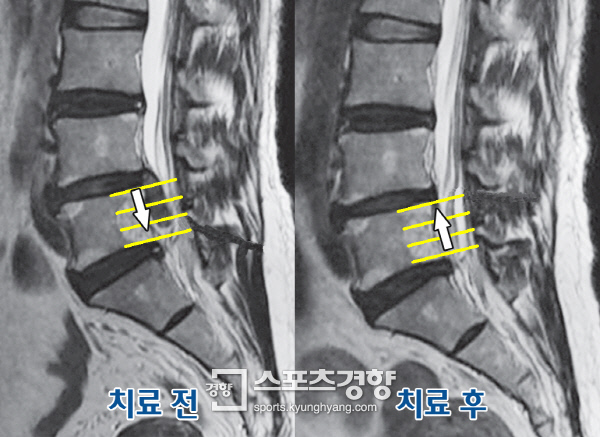 더디스크 이미지