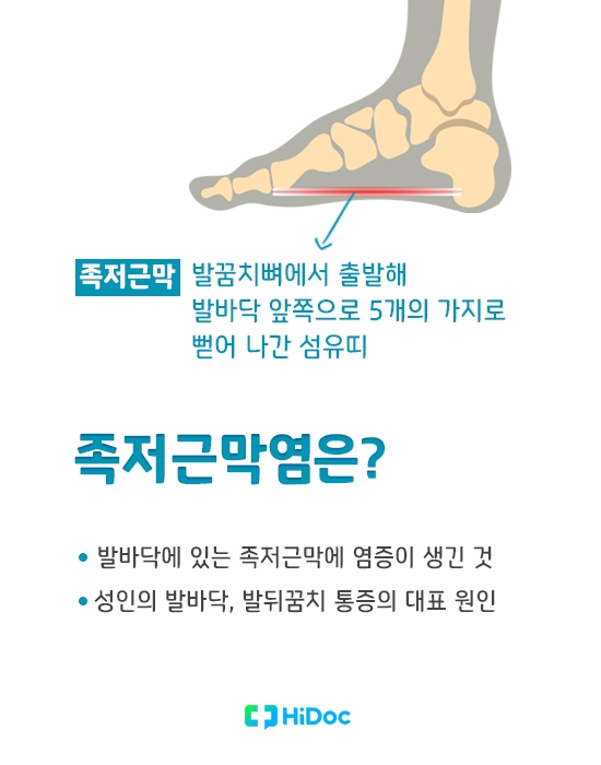 족저근막염 원인