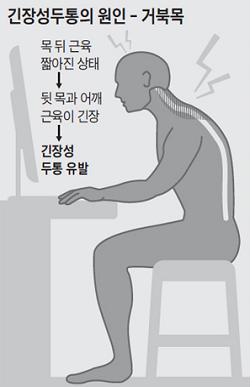 거북목이 지속되면 두통이 생길 수 있다/사진=헬스조선 DB