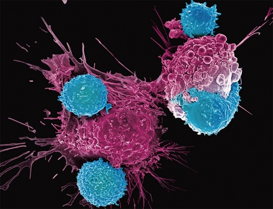 면역세포인 T세포를 유전자 편집한 CART세포( 파란색)가 암세포(붉은색)를 공격하고 있다. / 사진:메모리얼 슬로언 케터링 암 센터 제공