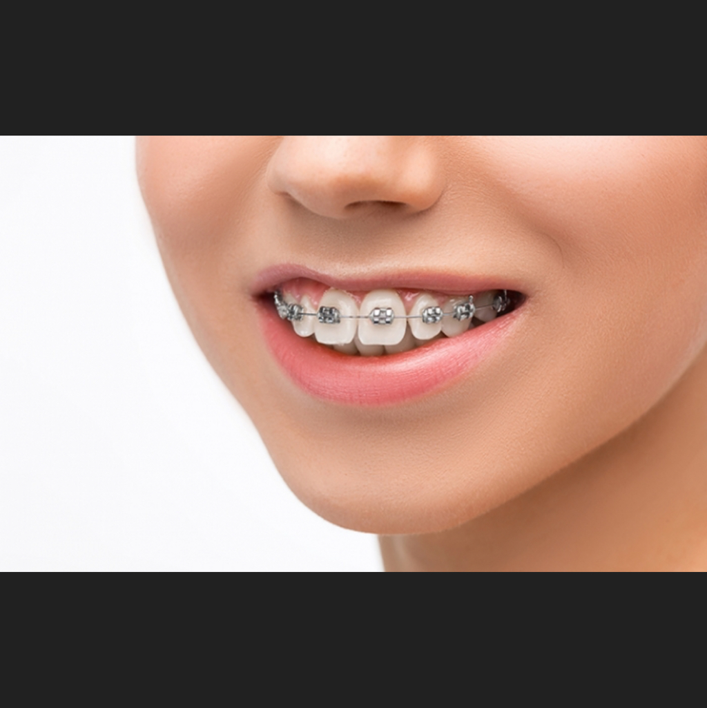 테이블 대표이미지