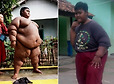 세계에서 가장 뚱뚱한 190kg 소년의 다이어트 성공기 | 인스티즈