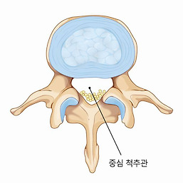 중심 척추관