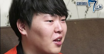 생각보다 우리나라에 환자 수가 많은 희귀질환 | 인스티즈