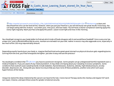 http://lug.ncsu.edu/fossfair/Is_Cystic_Acne_Leaving_Scars_stored_On_Your_Face_