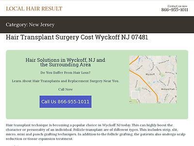 http://localhairresult.xyz/category/new-jersey/