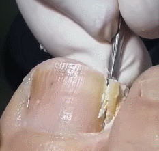 999AB53B5CD9502A081183